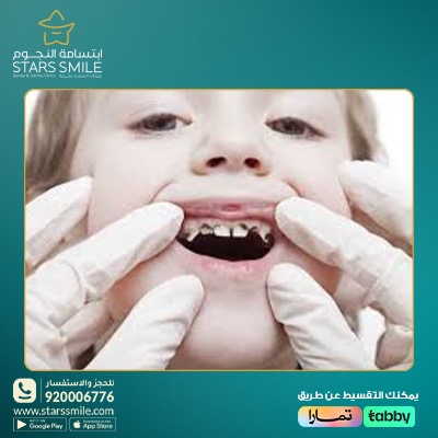 معلومات هامة للحفاظ على أسنان طفلك