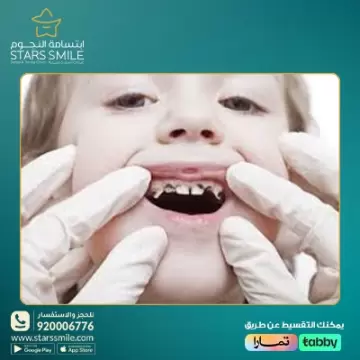 معلومات هامة للحفاظ على أسنان طفلك